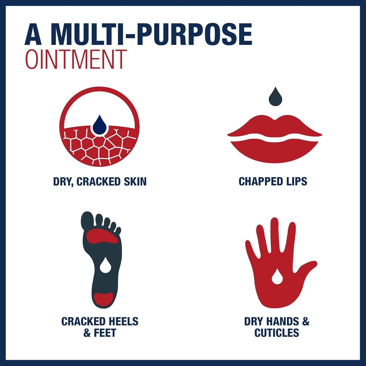 image:imageAquaphor Advanced Therapy Healing Ointment Multipack 4 x 035 OZ035 Ounce Pack of 2