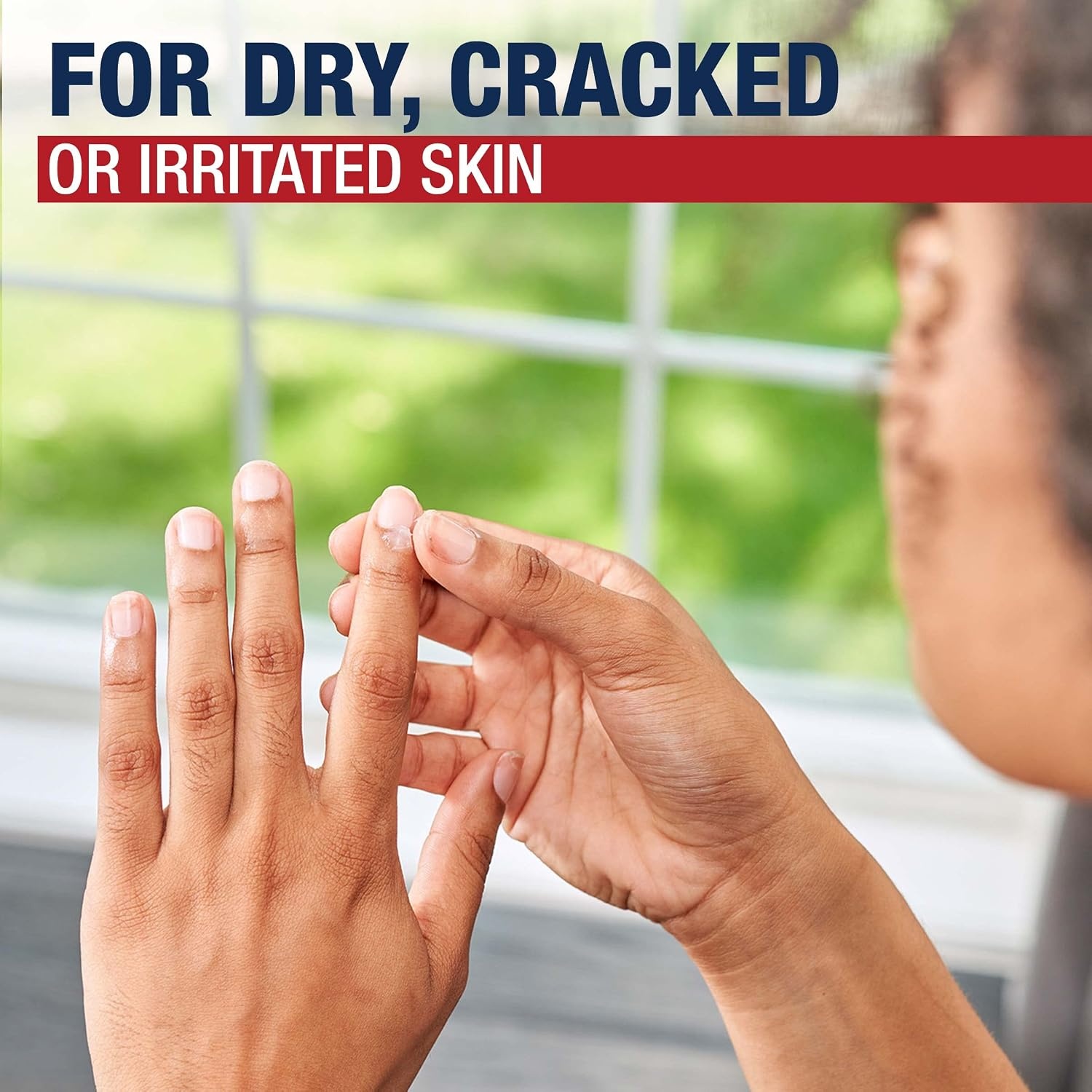 image:imageAquaphor Healing Ointment Skin Protectant for Dry Cracked Skin Hands Heels Elbows 35 oz Jar Pack of 335 Ounce Pack of 3