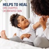 Aquaphor Children’s Advanced Therapy Healing Ointment, 1.75 OZ